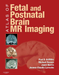 Atlas Of Fetal And Infant Brain Mr