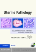 Uterine Pathology