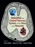 Imaging The Central Nervous System Of The Fetus And Neonate