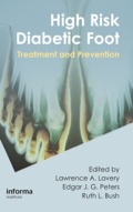 High Risk Diabetic Foot