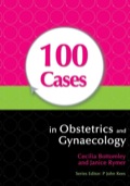 100 Cases In Obstetrics And Gynaecology