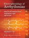 Electrophysiology of Arrhythmias: Practical Images for Diagnosis and Ablation