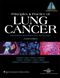 Principles and Practice of Lung Cancer: The Official Reference Text of the International Association for the Study of Lung Cancer (IASLC), Fourth Edition