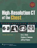 High-resolution Ct Of The Chest