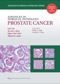 Advances in Surgical Pathology: Prostate Cancer