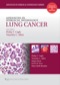 Advances in Surgical Pathology: Lung Cancer