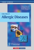 Color Atlas Of Allergic Diseases