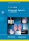 Artrosis: Fisiopatología, diagnóstico y tratamiento