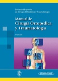 Manual De Cirugía Ortopédica Y Traumatología