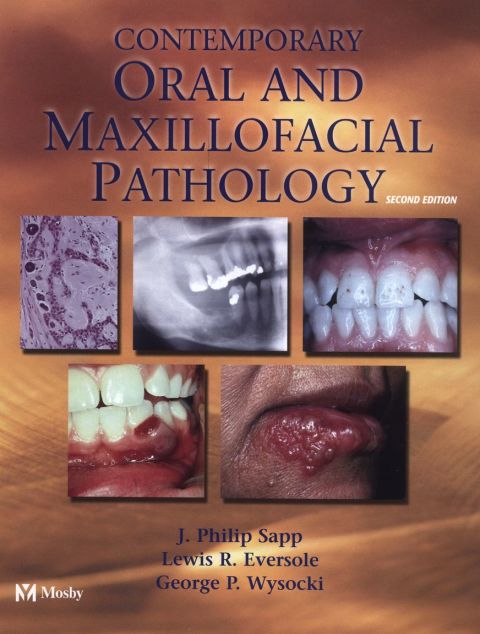 Cover image for book Contemporary Oral and Maxillofacial Pathology