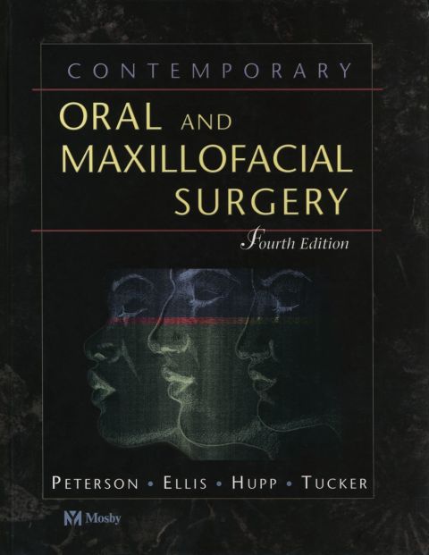 Cover image for book Contemporary Oral and Maxillofacial Surgery