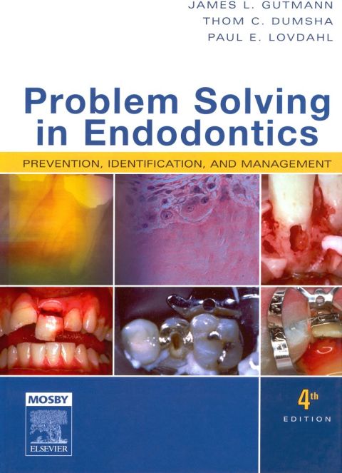 Cover image for book Problem Solving in Endodontics: Prevention, Identification, and Management