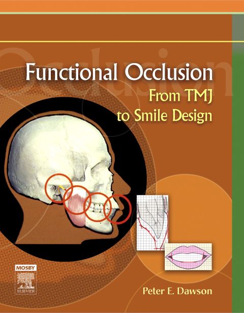 Cover image for book Functional Occlusion