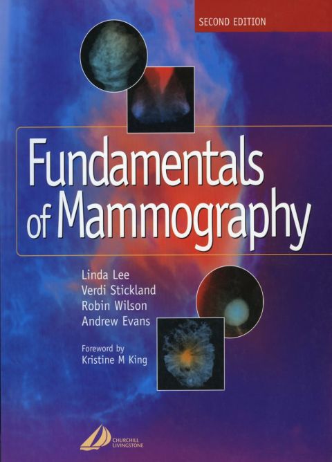 Cover image for book Fundamentals of Mammography