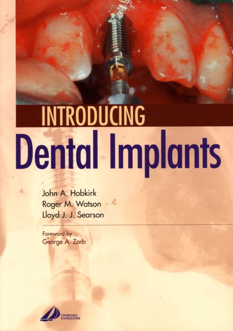Cover image for book Introducing Dental Implants