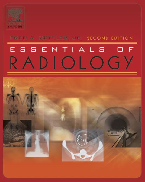 Cover image for book Essentials of Radiology