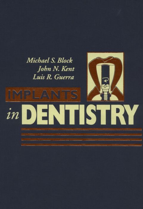 Cover image for book Implants in Dentistry: Essentials of Endosseous Implants for Maxillofacial Reconstruction