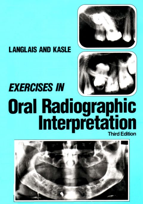Cover image for book Exercises in Oral Radiographic Interpretation