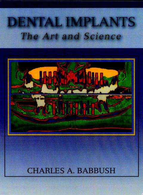 Cover image for book Dental Implants: The Art and Science