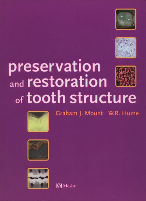 Cover image for book Preservation & Restoration of Tooth Structure
