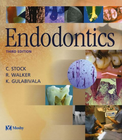 Cover image for book Endodontics