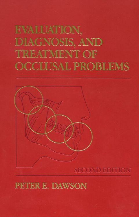 Cover image for book Evaluation, Diagnosis and Treatment of Occlusal Problems