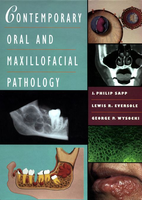 Cover image for book Contemporary Oral and Maxillofacial Pathology