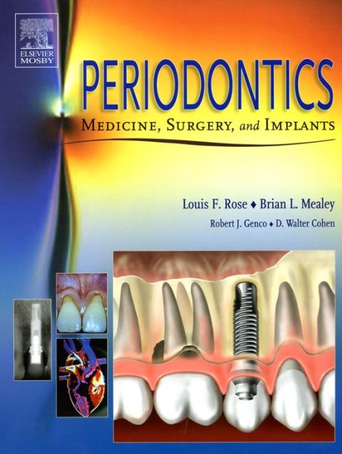 Cover image for book Periodontics: Medicine, Surgery and Implants