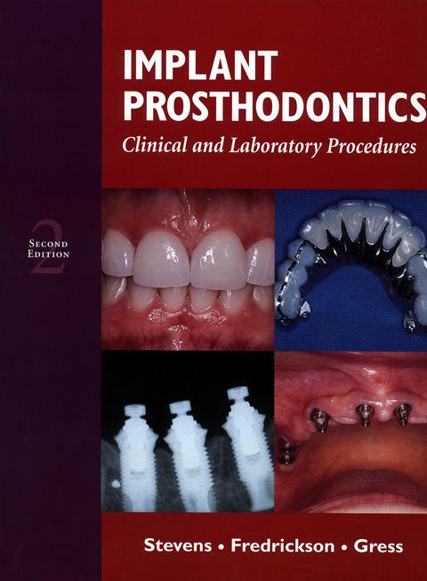 Cover image for book Implant Prosthodontics: Clinical and Laboratory Procedures
