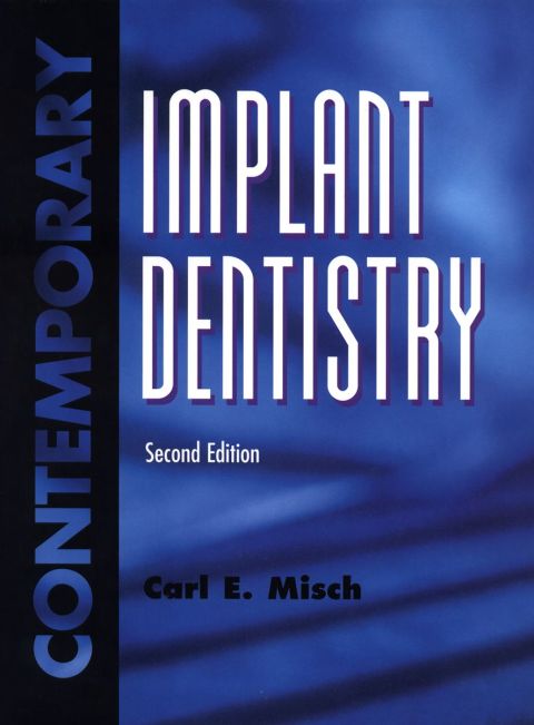 Cover image for book Contemporary Implant Dentistry