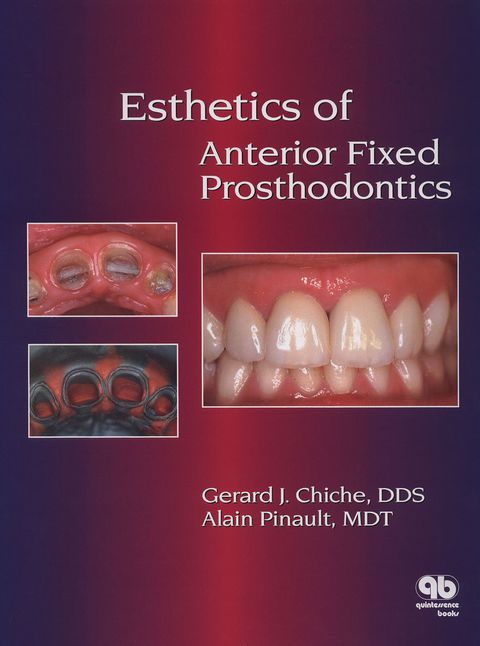 Cover image for book Esthetics of Anterior Fixed Prosthodontics: