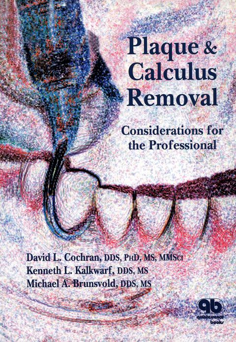 Cover image for book Plaque and Calculus Removal: Considerations for the Professional