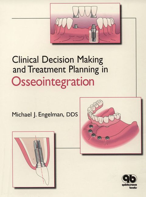 Cover image for book Clinical Decision Making and Treatment Planning in Osseointegration