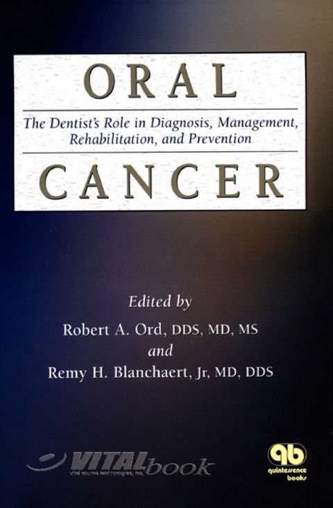 Cover image for book Oral Cancer: The Dentist's Role in Diagnosis, Management, Rehabilitation and Prevention