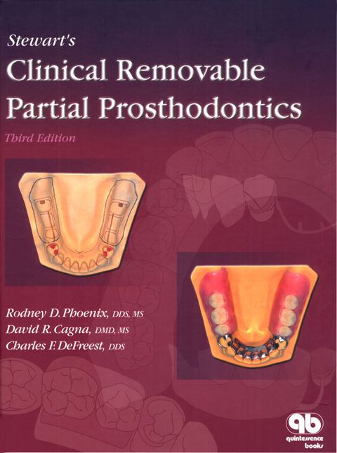 Cover image for book Stewart's Clinical Removable Partial Prosthodontics
