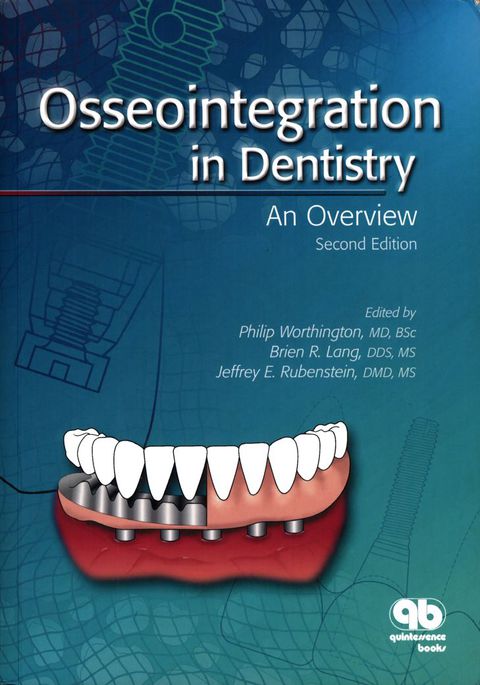 Cover image for book Osseointegration in Dentistry: An Overview