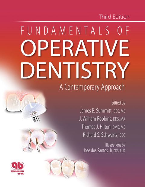 Cover image for book Fundamentals of Operative Dentistry: A Contemporary Approach