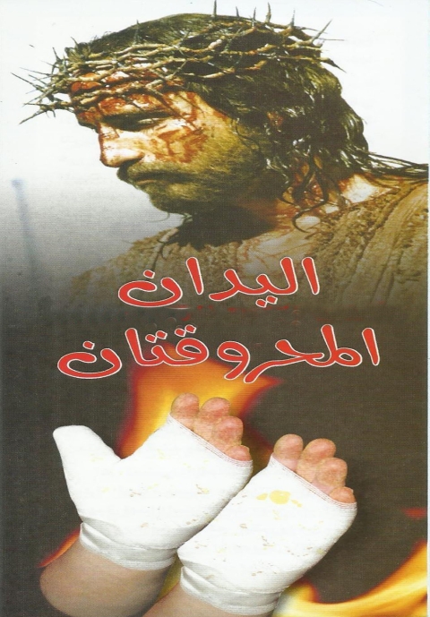 Cover image for book اليدان المحروقتان