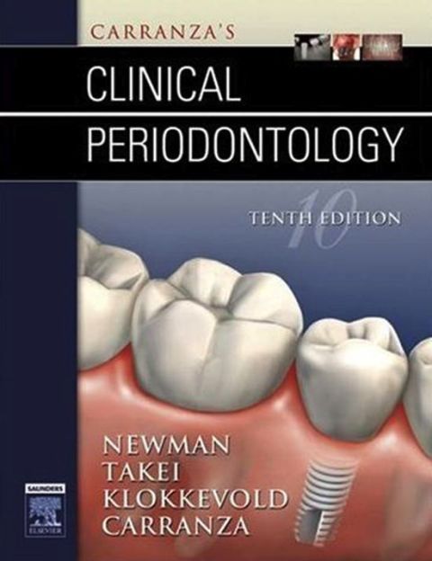 Cover image for book Carranza's Clinical Periodontology