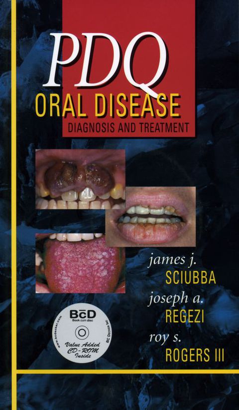 Cover image for book PDQ Oral Disease: Diagnosis and Treatment