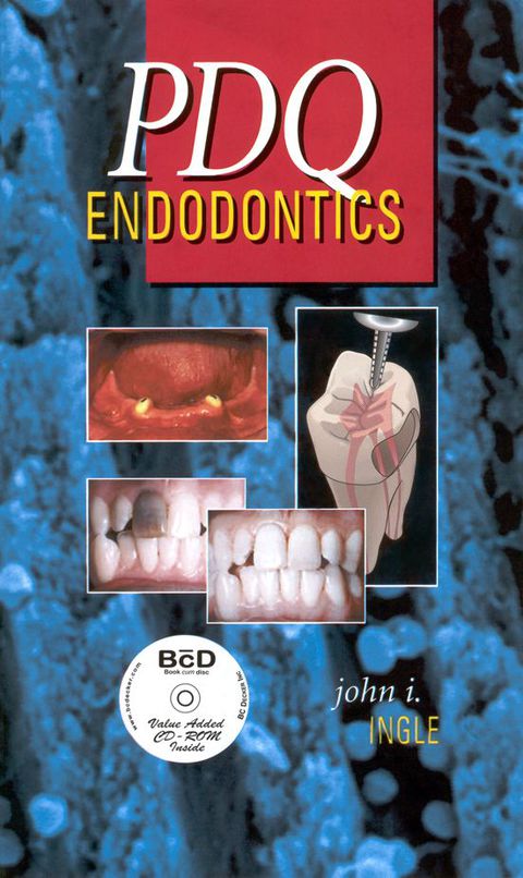 Cover image for book PDQ Endodontics