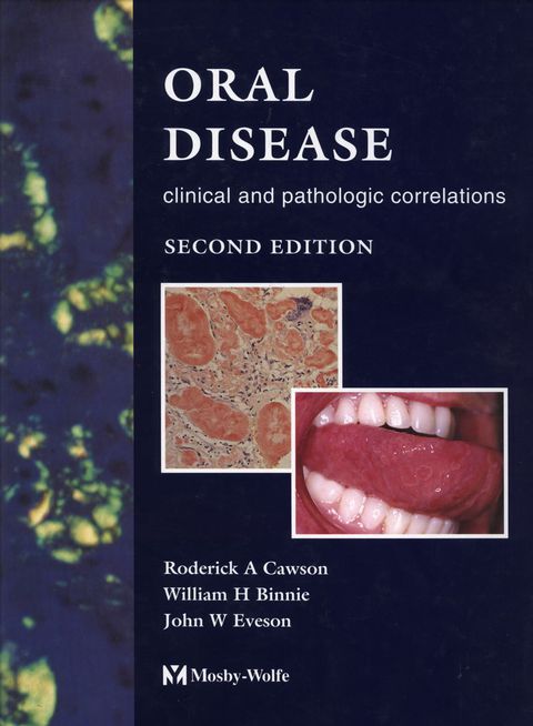 Cover image for book Color Atlas of Oral Disease: Clinical and Pathologic Correlations