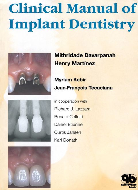 Cover image for book Clinical Manual of Implant Dentistry: