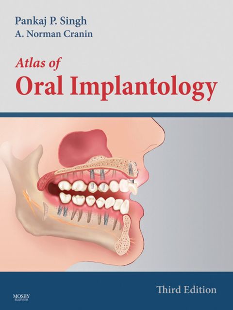 Cover image for book Atlas of Oral Implantology