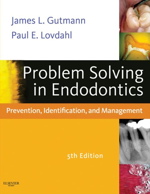 Cover image for book Problem Solving in Endodontics