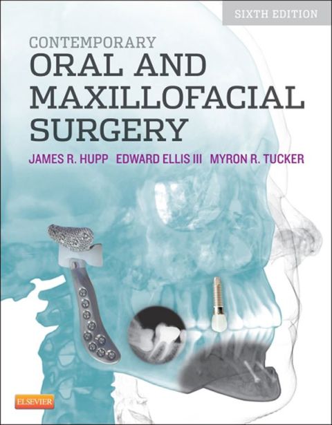 Cover image for book Contemporary Oral and Maxillofacial Surgery