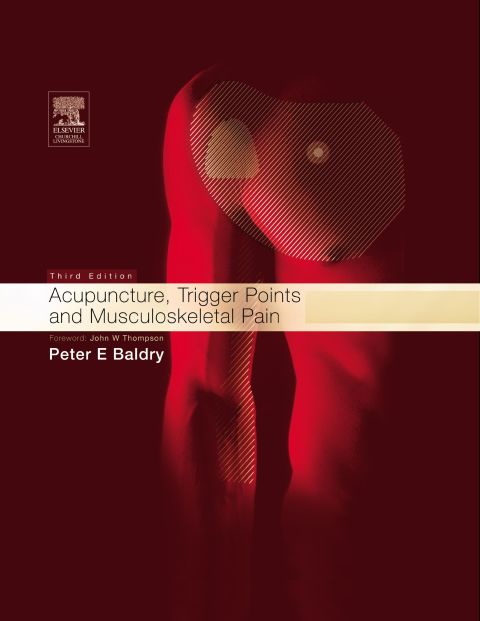 Cover image for book Acupuncture, Trigger Points and Musculoskeletal Pain