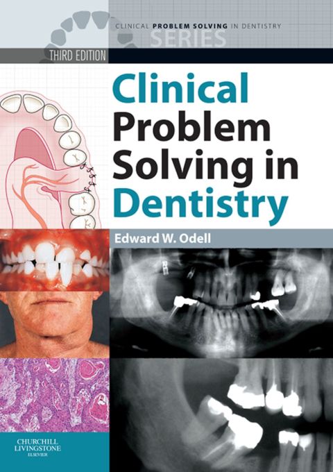 Cover image for book Clinical Problem Solving in Dentistry