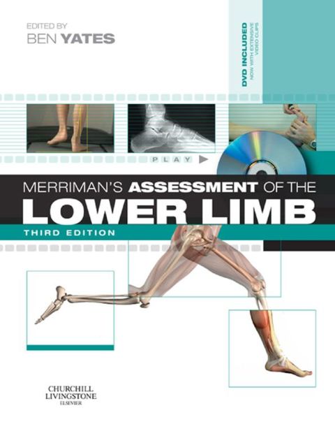 Cover image for book Merriman's Assessment of the Lower Limb
