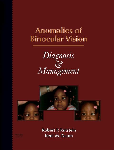 Cover image for book Anomalies of Binocular Vision: Diagnosis & Management